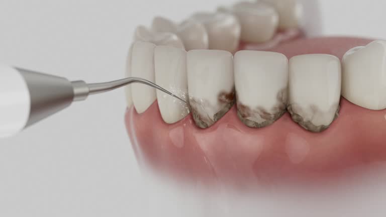 Trusted Tooth Extraction service in Bowling Green, MO - Dentist Open Now